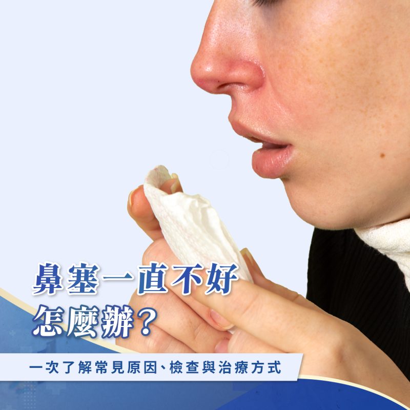 鼻塞一直不好怎麼辦？一次了解常見原因、檢查與治療方式 - 王恩盈醫師