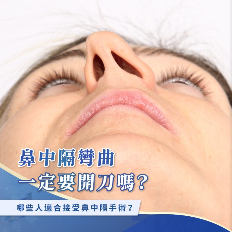 鼻中隔彎曲一定要開刀嗎？哪些人適合接受鼻中隔手術？ - 王恩盈醫師